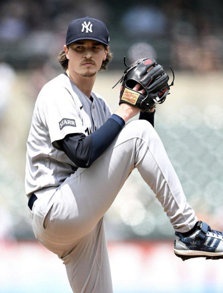Yankees colocarán a Max Fried en la lista de lesionados por problema en el codo
